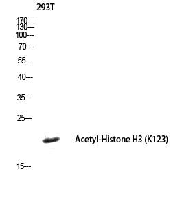  Western blot analysis of 293T lysis using histone3 antibody. Antibody was diluted at 1:1000. Secondary antibody(catalog#：RS0002) was diluted at 1:20000