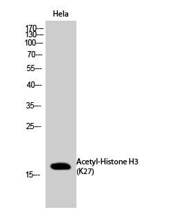  Western Blot analysis of Hela cells using Acetyl-Histone H3 (K27) Polyclonal Antibody diluted at 1：2000. Secondary antibody(catalog#：RS0002) was diluted at 1:20000