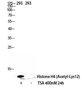  Western Blot analysis of 293 cells using Acetyl-Histone H4 (K12) Polyclonal Antibody diluted at 1：500. Secondary antibody(catalog#：RS0002) was diluted at 1:20000