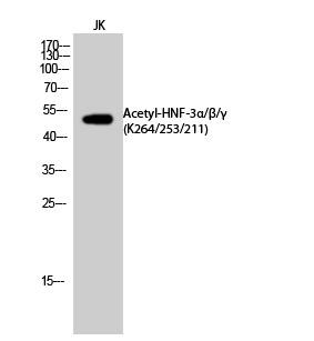  Western Blot analysis of JK cells using Acetyl-HNF-3α/β/γ (K264/253/211) Polyclonal Antibody. Secondary antibody(catalog#：RS0002) was diluted at 1:20000