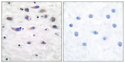  Immunohistochemistry analysis of paraffin-embedded human brain, using GluR1 (Phospho-Ser849) Antibody. The picture on the right is blocked with the phospho peptide.