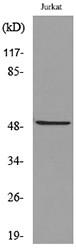  Western blot analysis of lysate from Jurkat cells, using FOXA1 (Acetyl-Lys265) Antibody.