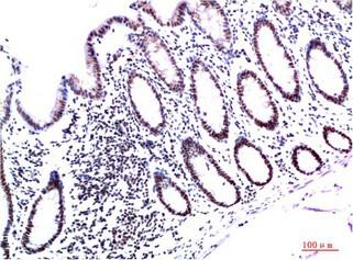 HP1-γ Mouse Monoclonal Antibody(3B9)