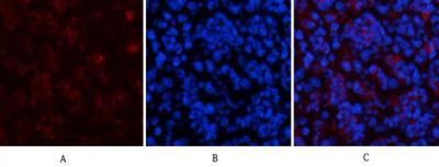 HP1-γ Mouse Monoclonal Antibody(2F5)