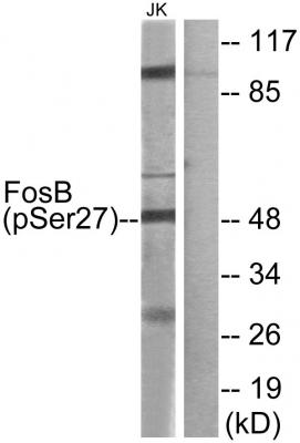  Western blot analysis of FosB (Phospho-Ser27) Antibody. The lane on the right is blocked with the FosB (Phospho-Ser27) peptide.