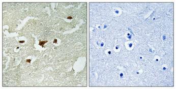  Immunohistochemical analysis of paraffin-embedded Human brain. Antibody was diluted at 1:100(4°,overnight). High-pressure and temperature Tris-EDTA,pH8.0 was used for antigen retrieval. Negetive contrl (right) obtaned from antibody was pre-absorbed by immunogen peptide.