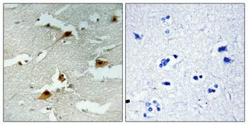  Immunohistochemical analysis of paraffin-embedded Human brain. Antibody was diluted at 1:100(4°,overnight). High-pressure and temperature Tris-EDTA,pH8.0 was used for antigen retrieval. Negetive contrl (right) obtaned from antibody was pre-absorbed by immunogen peptide.