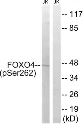  Western blot analysis of lysates from Jurkat cells treated with starved 24h, using FOXO4 (Phospho-Ser262) Antibody. The lane on the right is blocked with the phospho peptide.