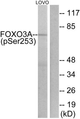  Western blot analysis of lysates from LOVO cells treated with serum 20% 30', using FKHRL1 (Phospho-Ser253) Antibody. The lane on the right is blocked with the phospho peptide.