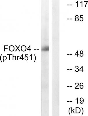  Western blot analysis of lysates from HUVEC cells treated with EGF 200ng/ml 5', using FOXO4 (Phospho-Thr451) Antibody. The lane on the right is blocked with the phospho peptide.