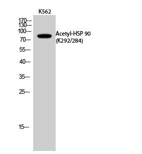  Western Blot analysis of K562 cells using Acetyl-HSP 90 (K292/284) Polyclonal Antibody. Secondary antibody(catalog#：RS0002) was diluted at 1:20000