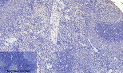  Immunohistochemical analysis of paraffin-embedded Rat-spleen tissue. 1,FoxO3A (phospho Ser253) Polyclonal Antibody was diluted at 1:200(4°C,overnight). 2, Sodium citrate pH 6.0 was used for antibody retrieval(>98°C,20min). 3,Secondary antibody was diluted at 1:200(room tempeRature, 30min). Negative control was used by secondary antibody only.