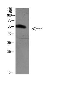  Western blot analysis of 3T3 mouse-kidney KB K562 Hela lysate, antibody was diluted at 500. Secondary antibody(catalog#：RS0002) was diluted at 1:20000