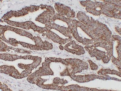 HSP60 (9A1) mouse Monoclonal Antibody