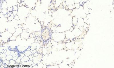  Immunohistochemical analysis of paraffin-embedded Rat-lung tissue. 1,FoxO3A (phospho Ser253) Polyclonal Antibody was diluted at 1:200(4°C,overnight). 2, Sodium citrate pH 6.0 was used for antibody retrieval(>98°C,20min). 3,Secondary antibody was diluted at 1:200(room tempeRature, 30min). Negative control was used by secondary antibody only.