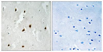  Immunohistochemistry analysis of paraffin-embedded human brain, using FOXO4 (Phospho-Ser262) Antibody. The picture on the right is blocked with the phospho peptide.