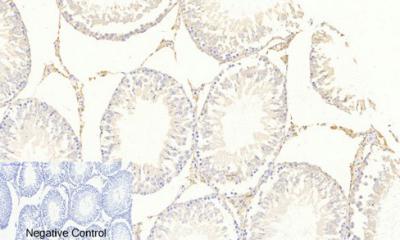  Immunohistochemical analysis of paraffin-embedded Rat-testis tissue. 1,FoxO3A (phospho Ser253) Polyclonal Antibody was diluted at 1:200(4°C,overnight). 2, Sodium citrate pH 6.0 was used for antibody retrieval(>98°C,20min). 3,Secondary antibody was diluted at 1:200(room tempeRature, 30min). Negative control was used by secondary antibody only.