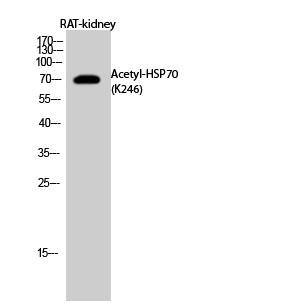  Western Blot analysis of RAT-kidney cells using Acetyl-HSP70 (K246) Polyclonal Antibody diluted at 1：1000. Secondary antibody(catalog#：RS0002) was diluted at 1:20000
