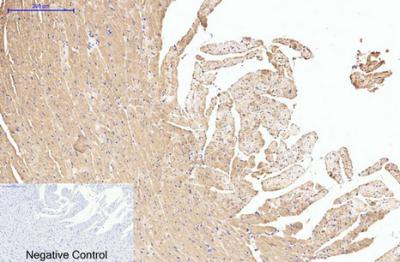  Immunohistochemical analysis of paraffin-embedded Rat-heart tissue. 1,HSP90β Monoclonal Antibody(M2) was diluted at 1:200(4°C,overnight). 2, Sodium citrate pH 6.0 was used for antibody retrieval(>98°C,20min). 3,Secondary antibody was diluted at 1:200(room tempeRature, 30min). Negative control was used by secondary antibody only.