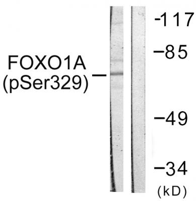  Western blot analysis of lysates from HeLa cells treated with Serum 20% 15', using FOXO1A (Phospho-Ser329) Antibody. The lane on the right is blocked with the phospho peptide.