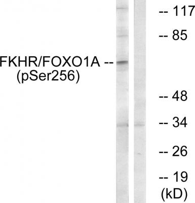  Western blot analysis of lysates from HeLa cells treated with EGF+Serum, using FKHR (Phospho-Ser256) Antibody. The lane on the right is blocked with the phospho peptide.