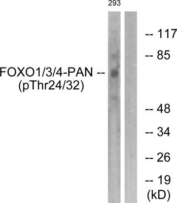  Western blot analysis of lysates from 293 cells treated with Serum 20% 15', using FOXO1/3/4-pan (Phospho-Thr24/32) Antibody. The lane on the right is blocked with the phospho peptide.