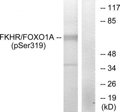  Western blot analysis of lysates from HeLa cells treated with EGF, using FKHR (Phospho-Ser319) Antibody. The lane on the right is blocked with the phospho peptide.