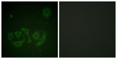  Immunofluorescence analysis of HepG2 cell, using GAB1 (Phospho-Tyr659) Antibody. The lane on the right is blocked with the GAB1 (Phospho-Tyr659) peptide.