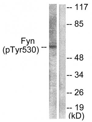  Western blot analysis of lysates from 293 cells treated with H2O2 100uM 15', using Fyn (Phospho-Tyr530) Antibody. The lane on the right is blocked with the phospho peptide.