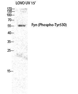  Western Blot analysis of LOVO+UV cells using Phospho-Fyn (Y530) Polyclonal Antibody diluted at 1：2000