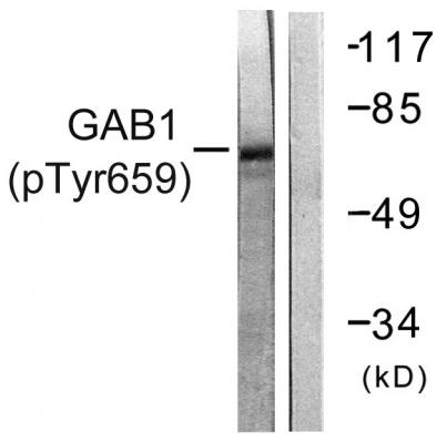  Western blot analysis of GAB1 (Phospho-Tyr659) Antibody. The lane on the right is blocked with the GAB1 (Phospho-Tyr659) peptide.