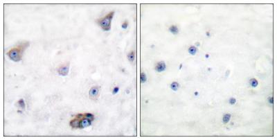  Immunohistochemistry analysis of paraffin-embedded human brain, using GABA-RB (Phospho-Ser434) Antibody. The picture on the right is blocked with the phospho peptide.