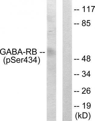  Western blot analysis of lysates from COS7 cells, using GABA-RB (Phospho-Ser434) Antibody. The lane on the right is blocked with the phospho peptide.