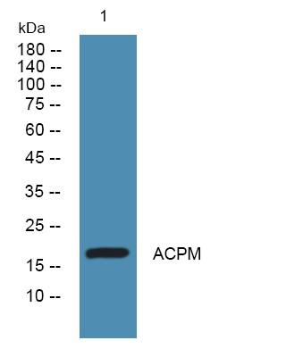 ACPM Polyclonal Antibody